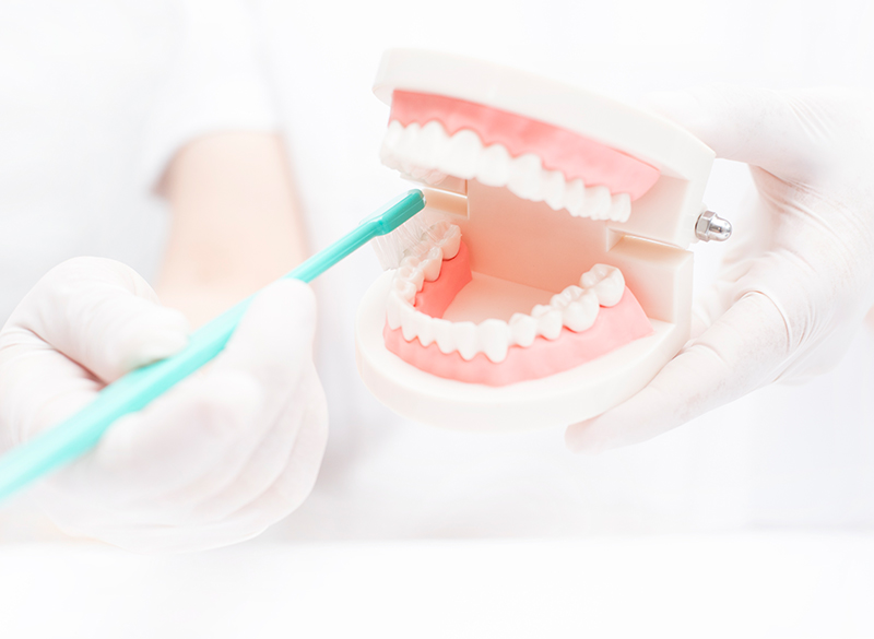 予防・クリーニング