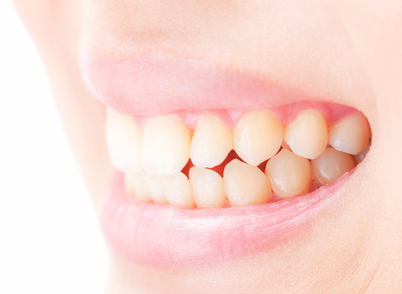 歯ぎしり・食いしばり