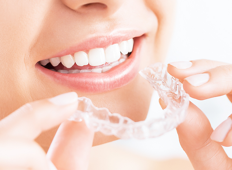 各種マウスピース製作