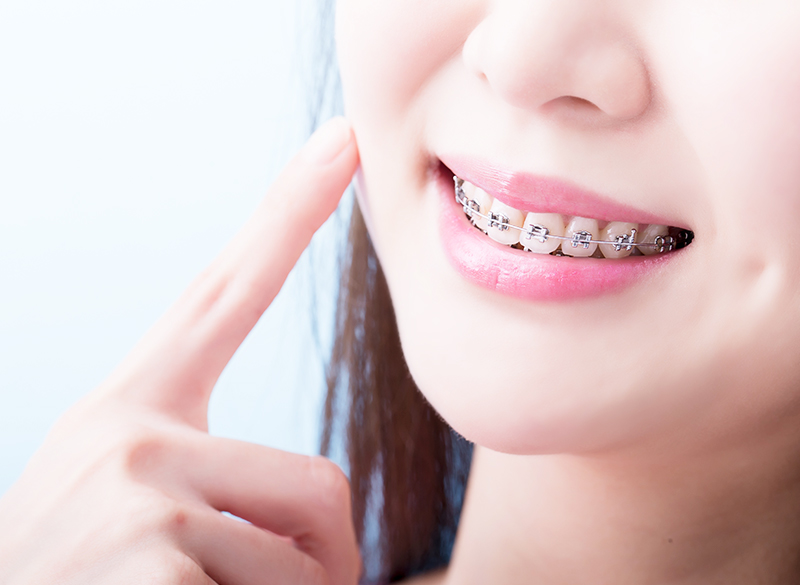 矯正歯科・小児矯正歯科