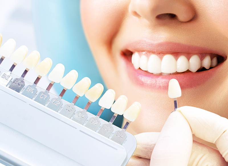 ホワイトニング